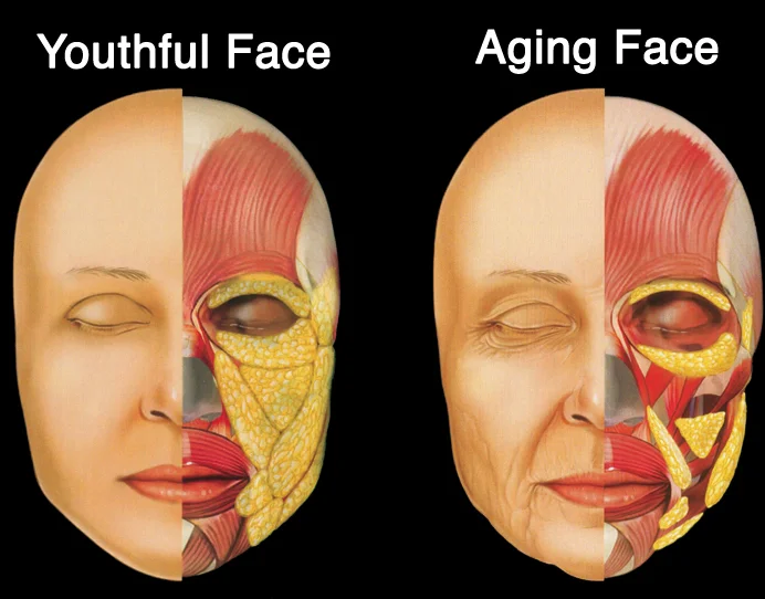Illustration of a youthful face beside an aging face, each half cut away to show the facial muscles and fat pads beneath the skin